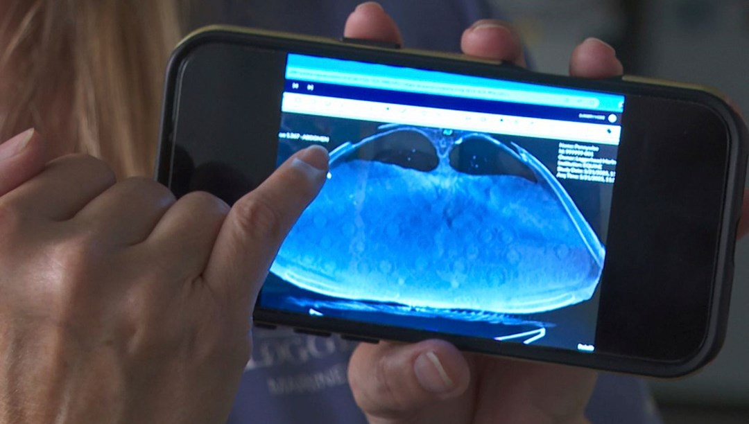 Caretta caretta tomografiye alındı, görüntülerden “sürpriz” çıktı
