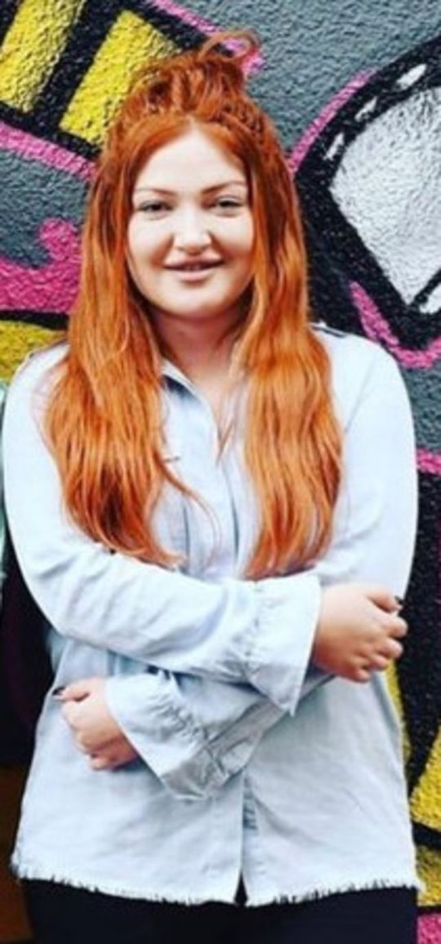 Estetik ameliyatlara servet harcadı