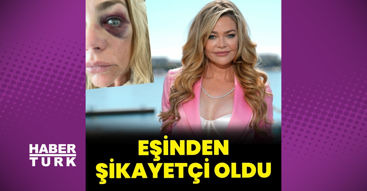 Ünlü oyuncu eşinden şiddet gördü